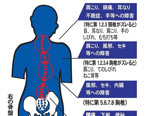 骨盤の歪みと背骨  800