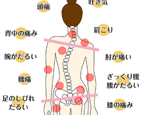 背骨ゆがみ