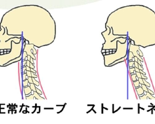 くび