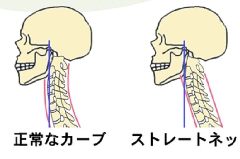 くび