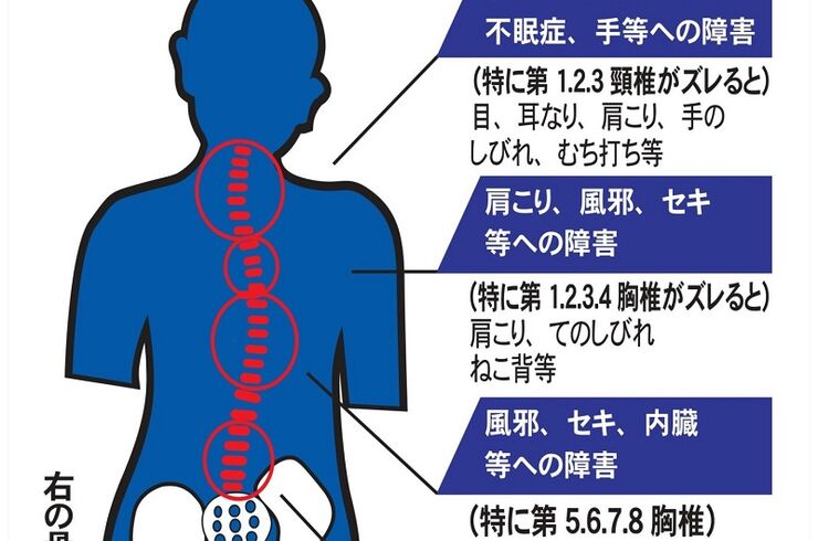 骨盤の歪みと背骨  800